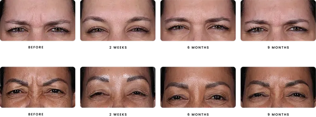 Expressions showing various eye emotions and conditions.