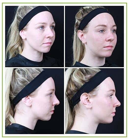 Woman with headband, four profile views.