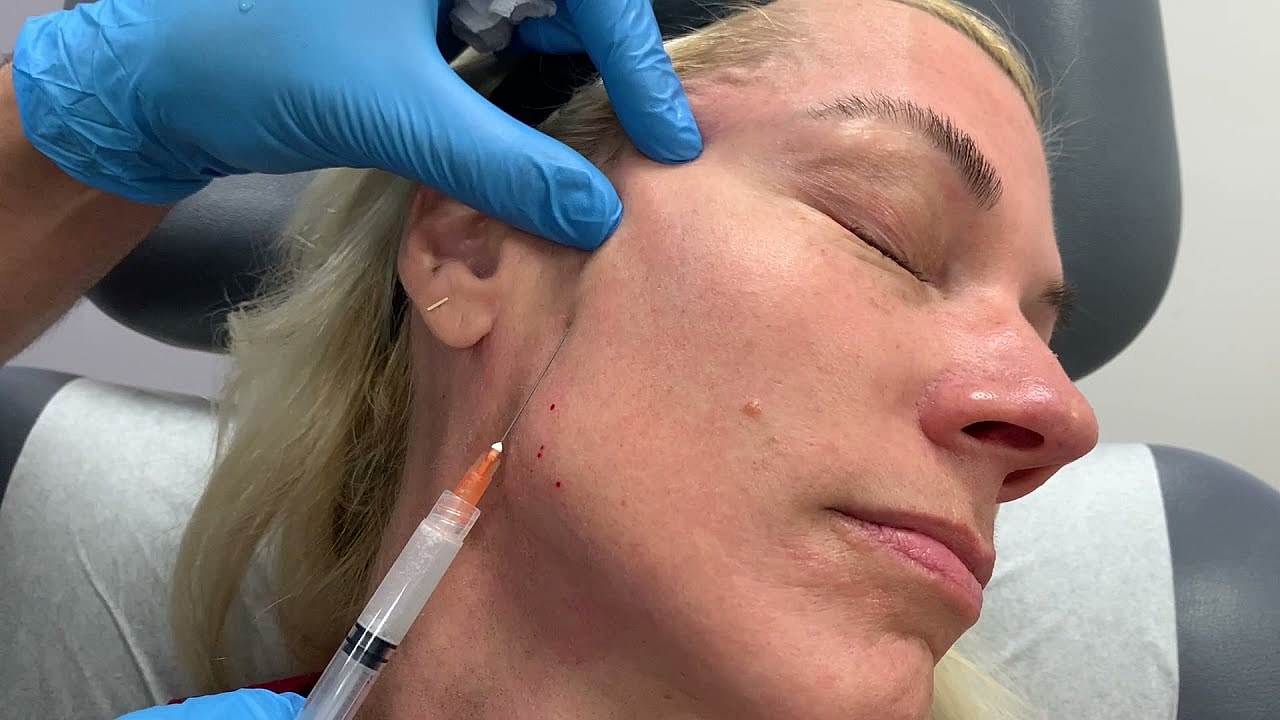 Injecting treatment into a woman's cheek.