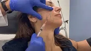 Medical professional administering facial injection treatment.