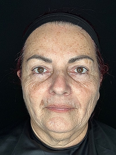Woman with visible facial wrinkles and natural expression.