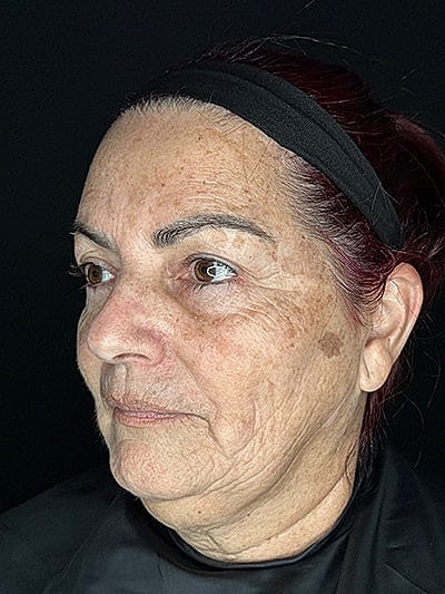 Woman with mature skin and dark hair.