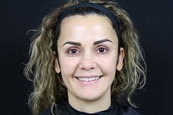 Dermal Fillers Before & After