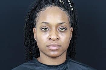 Dermal Fillers Before & After