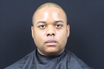 Dermal Fillers Before & After