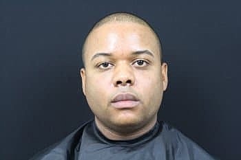 Dermal Fillers Before & After