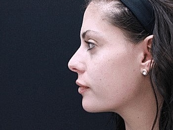 Profile of a young woman against a dark background.