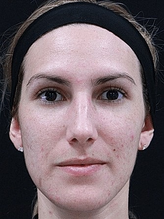Close-up of a woman with a neutral expression.