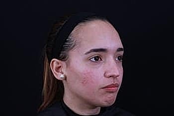 Young woman with a neutral expression.