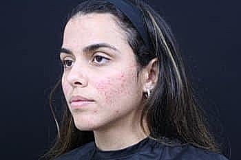 Young woman with natural makeup and clear skin.