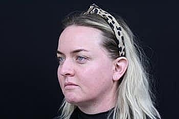 Profile view of woman with blonde hair.