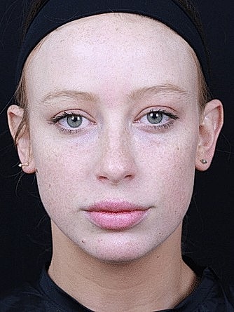 Woman with freckles and minimal makeup.