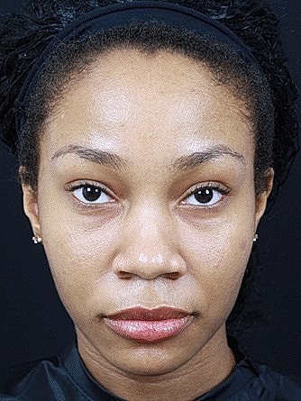 Woman with natural makeup and neutral expression.