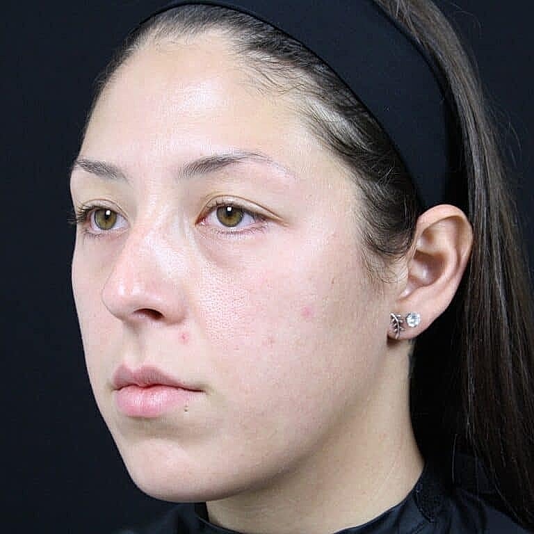 Young woman with earrings, neutral expression, close-up.