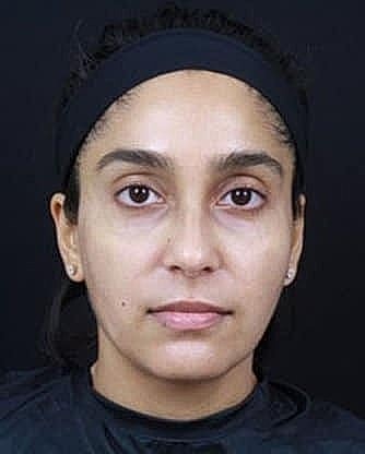 Woman with bare face and neutral expression.