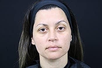 Woman with neutral expression against dark background.