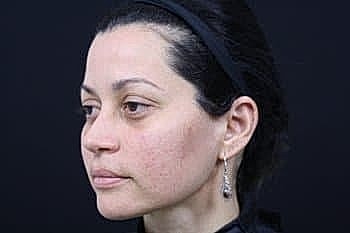 Profile of a woman with dark hair.