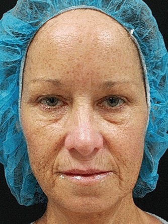Person wearing a surgical cap and no makeup.