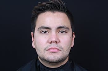 Skin Rejuvenation Before & After