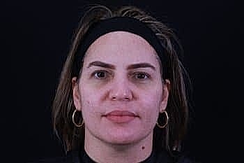 Person with neutral expression against black background.