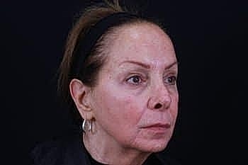 Older woman with a serious expression, dark background.