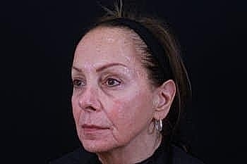 Profile of an older woman against a dark background