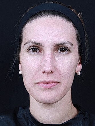 Female portrait with neutral expression and headband.
