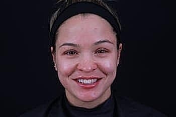 Smiling woman with clear skin on black background.