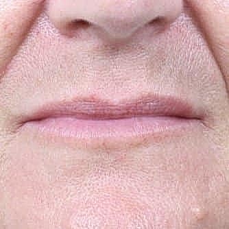 Close-up of a person's lips and chin.
