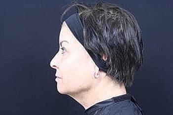 Profile view of woman with short hair.