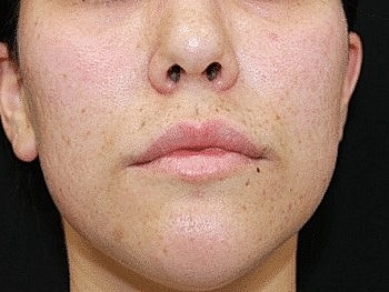 Close-up of woman's face, natural skin texture.