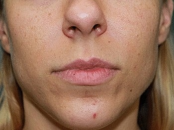 Close-up of a woman's chin and lips.