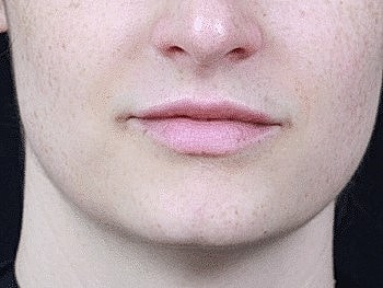 Close-up of lips and chin on light skin.