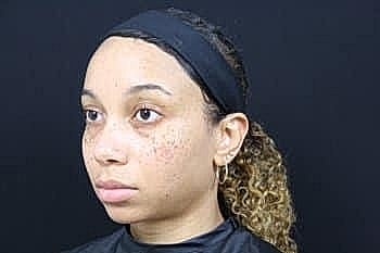 Person with curly hair and headband, neutral expression.