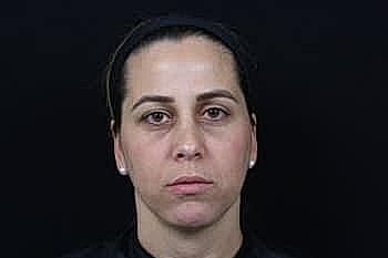 Woman with a neutral expression against dark background.