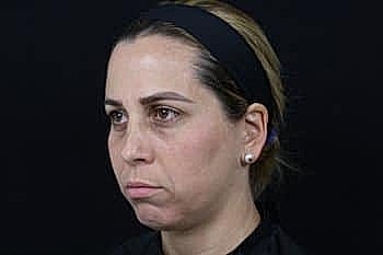 Frustrated woman with neutral expression against dark background.