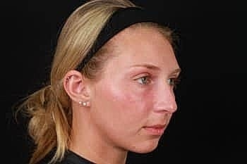 Profile view of a woman with blonde hair.