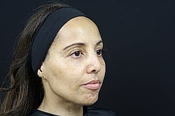 Woman with headband against dark background.
