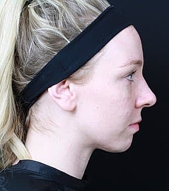 Profile of a woman with long blonde hair.