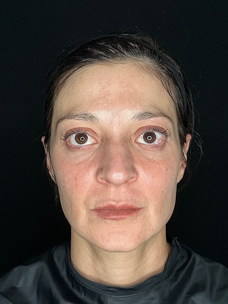 Close-up portrait of a woman, neutral expression.