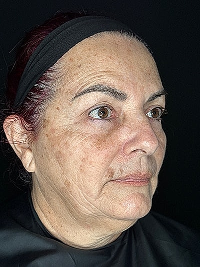 Woman with makeup-free face against dark background.