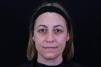 Woman with a neutral expression against black background.