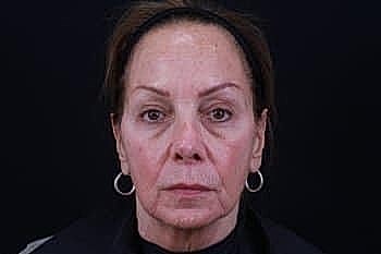 Female portrait with neutral expression on dark background.