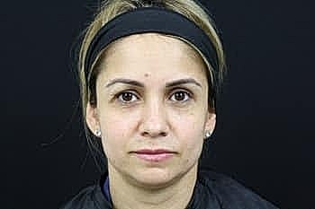 Woman with neutral expression against black background.