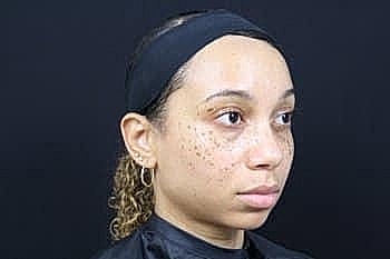 Woman with freckles in profile against black background