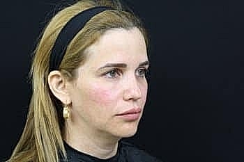 Woman with long hair in profile view.