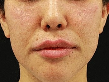 Close-up of a woman's face with natural skin.