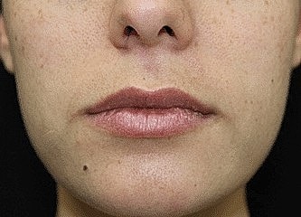 Close-up of a woman's lips and chin.