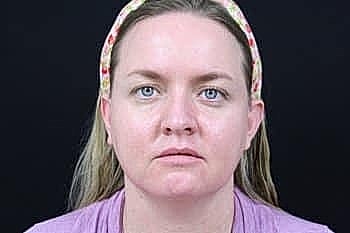 Woman with headband looking directly at camera.