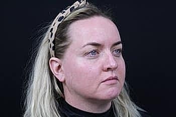 Woman with blonde hair and headband facing forward.